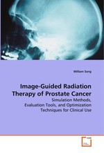 Image-Guided Radiation Therapy of Prostate Cancer. Simulation Methods, Evaluation Tools, and Optimization Techniques for Clinical Use