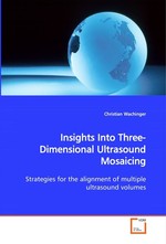 Insights Into Three-Dimensional Ultrasound Mosaicing. Strategies for the alignment of multiple ultrasound volumes