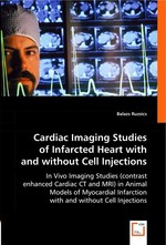Cardiac Imaging Studies of Infarcted Heart with and without Cell Injections. In Vivo Imaging Studies (contrast enhanced Cardiac CT and MRI) in Animal Models of Myocardial Infarction with and without Cell Injections