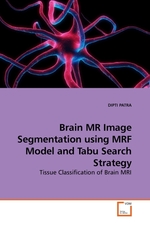 Brain MR Image Segmentation using MRF Model and Tabu Search Strategy. Tissue Classification of Brain MRI