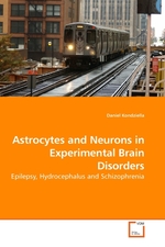 Astrocytes and Neurons in Experimental Brain Disorders. Epilepsy, Hydrocephalus and Schizophrenia