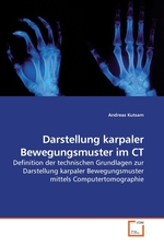 Darstellung karpaler Bewegungsmuster im CT. Definition der technischen Grundlagen zur Darstellung karpaler Bewegungsmuster mittels Computertomographie