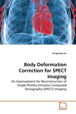 Body Deformation Correction for SPECT Imaging. An Improvement for Reconstruction of Single Photon Emission Computed Tomography (SPECT) Imaging