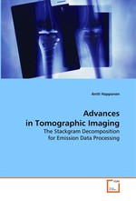 Advances in Tomographic Imaging. The Stackgram Decomposition for Emission Data Processing