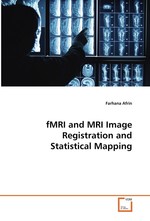 fMRI and MRI Image Registration and Statistical  Mapping