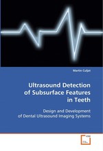 Ultrasound Detection of Subsurface Features in Teeth. Design and Development of Dental Ultrasound Imaging Systems