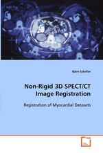 Non-Rigid 3D SPECT/CT Image Registration. Registration of Myocardial Datasets