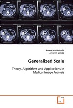 Generalized Scale. Theory, Algorithms and Applications in Medical Image Analysis