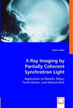 X-Ray Imaging by Partially Coherent Synchrotron Light. Application to Metallic Alloys, Tooth Dentin and Natural Rock