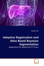 Adaptive Registration and Atlas Based Bayesian Segmentation. Application for Abdominal CT Scans