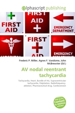 AV nodal reentrant tachycardia