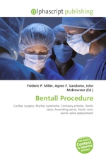 Bentall Procedure