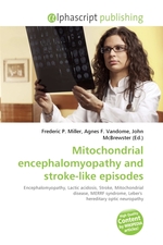 Mitochondrial encephalomyopathy and stroke-like episodes