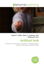Artificial limb