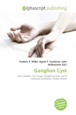 Ganglion Cyst